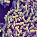 Bifidobacterium infantis