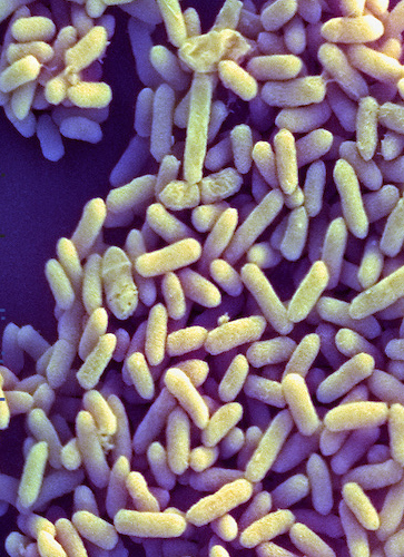 Bifidobacterium infantis