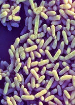 Bifidobacterium infantis